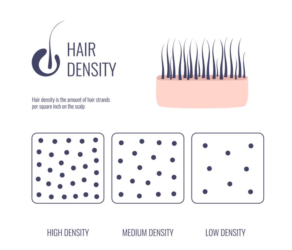 Illustration explaining hair density and female hair loss with an image of hair strands in skin and three diagrams showing high, medium, and low density of dots representing hair strands per area.