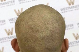 Close-up view of a person holding a cantaloupe with the focus on the textured rind, against a blurred background featuring the word "webster" repeated.