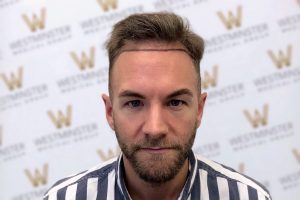 A man with hair replacement and a beard, wearing a striped shirt, stands in front of a backdrop with a repeated 'w' logo pattern. He is looking directly at the camera with a subtle smile