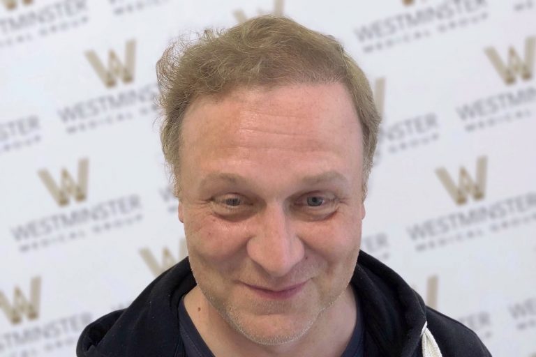 A middle-aged man with visible signs of male pattern baldness and a slight smile, wearing a dark jacket over a hoodie, stands in front of a background with repeated "westmaster" logos.