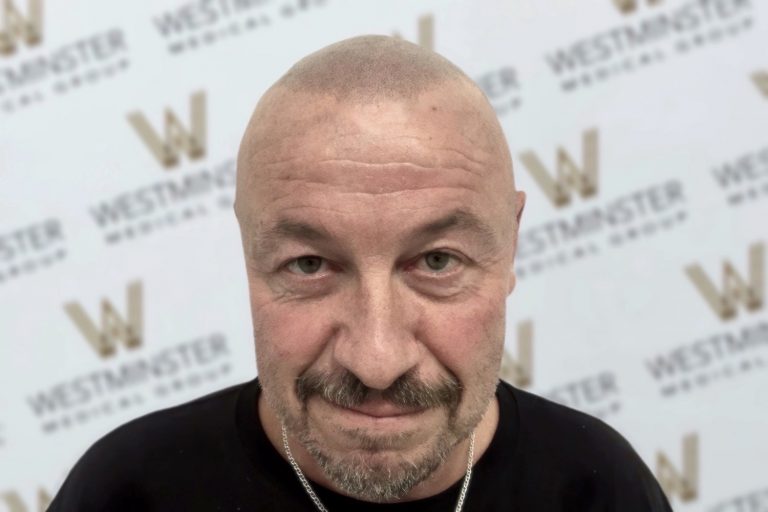A close-up portrait of a bald man with a beard, smiling at the camera in front of a backdrop with the "Westminster" logo repeated. His expression is friendly, and he wears a black