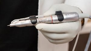A close-up of a hand wearing a white glove holding a medical device labeled "ugraft zeus" used for precise hair implant procedures.