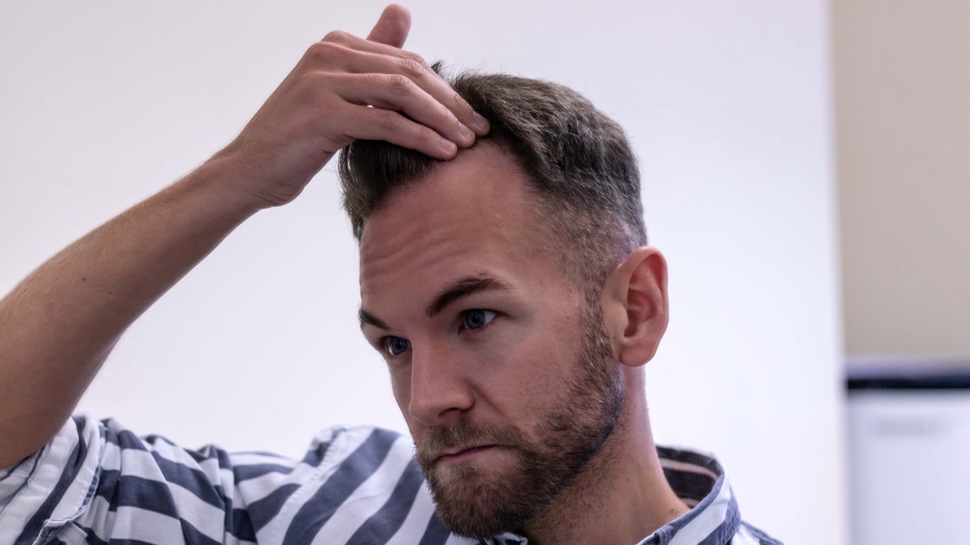 A man with a beard and short hair, wearing a striped shirt, looks intently while touching his scalp, as if examining signs of male pattern baldness in an indoor setting.