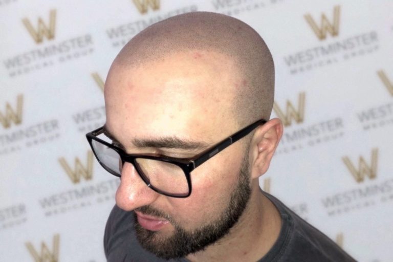 A man with male pattern baldness and dark-framed glasses, looking downward against a backdrop with the repeated "westminster" logo.
