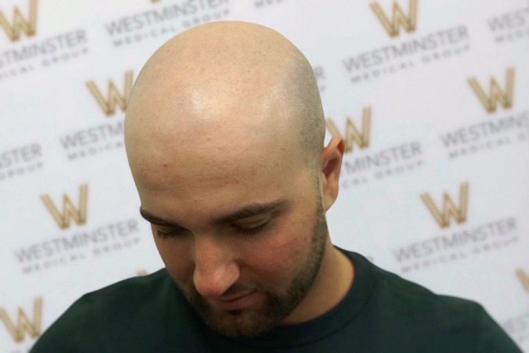 A man with male pattern baldness and a beard, dressed in a green shirt, looking downward in front of a background with repeated "Westminster" logos.