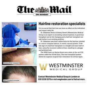 An advertisement for a hair implant clinic, featuring before and after images of a man's hairline, with contact information and a logo for Westminster Medical Group.