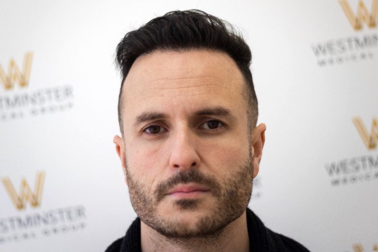 A man with hair replacement for short dark hair and a light beard in front of a backdrop with the "westminster record store" logo, looking directly at the camera.