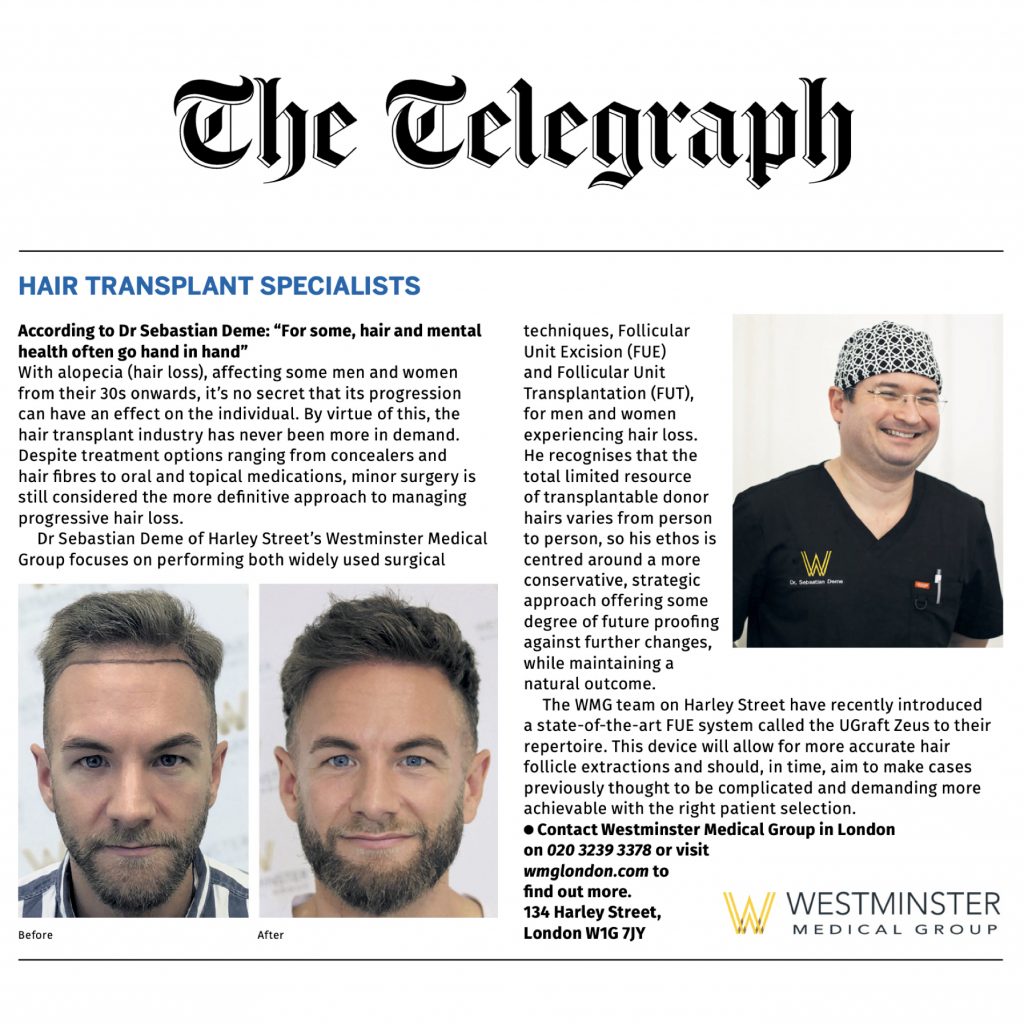 Image of a newspaper layout featuring two photos of a man’s head illustrating hair implant results. The left photo shows before treatment, the right shows after. Includes texts about the procedure and contact information for the