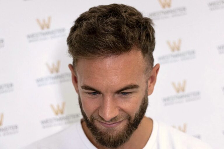 A close-up photo of a man with a light beard and hair implant, smiling slightly, looking downwards. He is wearing a white t-shirt, against a blurred background with promotional logos.