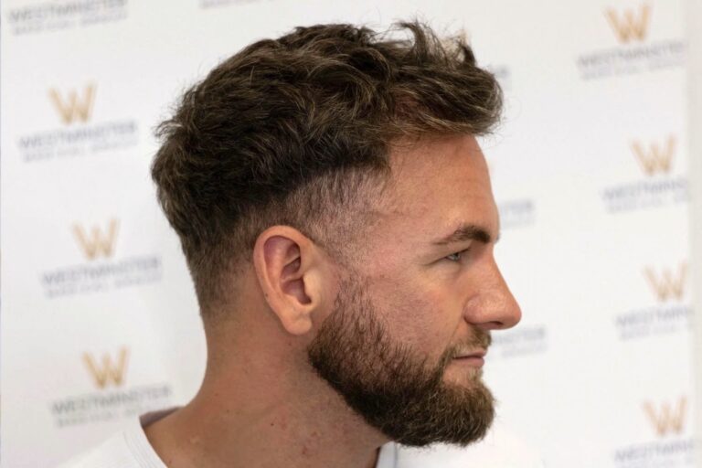 Profile view of a man with a styled, faded hair replacement and a full beard, standing in front of a backdrop with a logo.