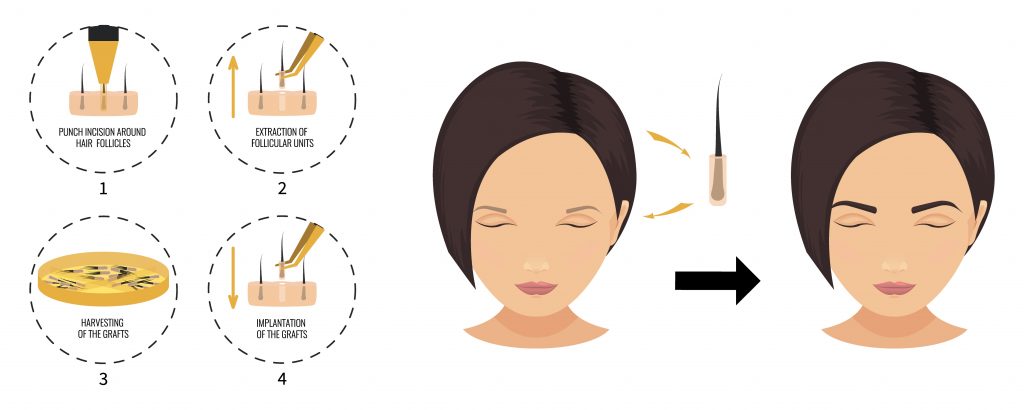Illustration depicting a step-by-step guide for applying makeup primer, featuring two face diagrams and four smaller circles demonstrating product placement and technique, with additional tips for female hair loss management.