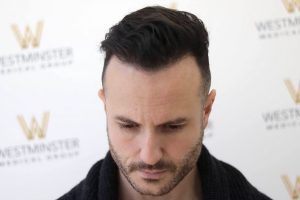 A man with a stylish hair implant looking down, in front of a backdrop with the Westminster Medical logo. He wears a dark sweater with a textured collar.