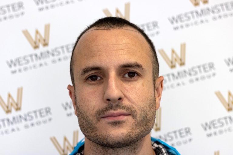 A close-up portrait of a man with short, cropped hair and stubble, standing in front of a background with the Westminster Medical Group logo repeated in a pattern advertising hair regrowth treatments.