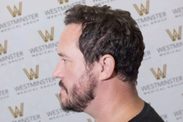 The image shows a side profile of a man with curly hair, standing in front of a backdrop featuring the "Westminster Medical Group" logo. He appears to be looking to the side, possibly considering