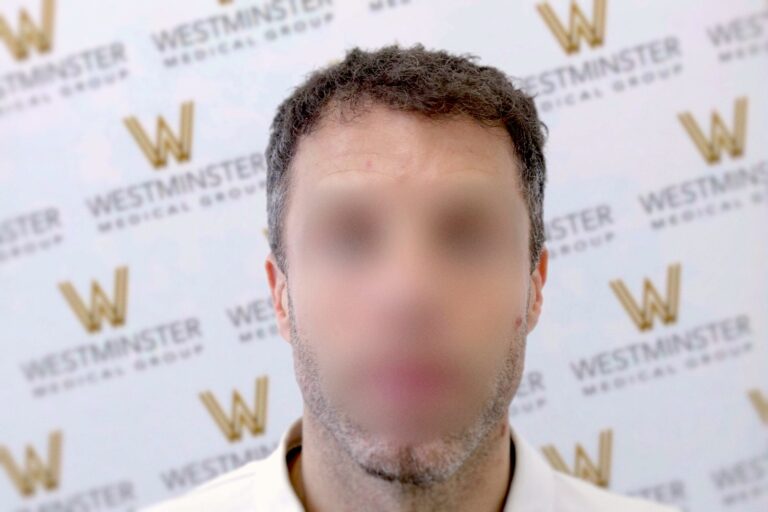 A man's blurred face is centered against a backdrop with the "westminster" logo repeated. He wears a white shirt, with clear focus on his curly hair and background, addressing male pattern baldness