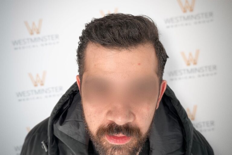 A blurred photo of a man with his face obscured, focusing on his curly hair, against a background with a repeating "westminster" logo. He is wearing a white shirt and displaying signs of early
