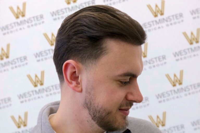 A profile view of a young man with neat, slicked-back hair replacement, smiling slightly, in front of a backdrop featuring the Westminster logo pattern.
