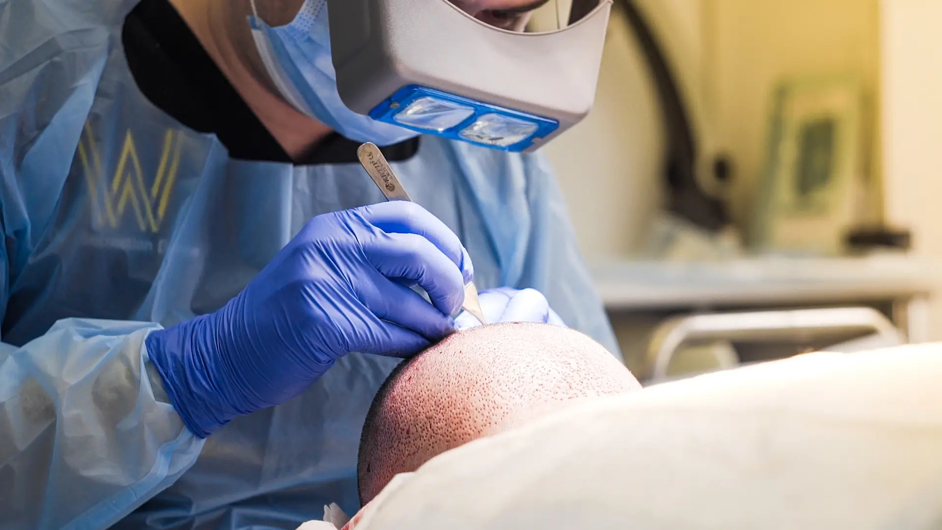 A surgeon wearing blue scrubs, gloves, and a headlamp examines a patient's head during a hair implant procedure.