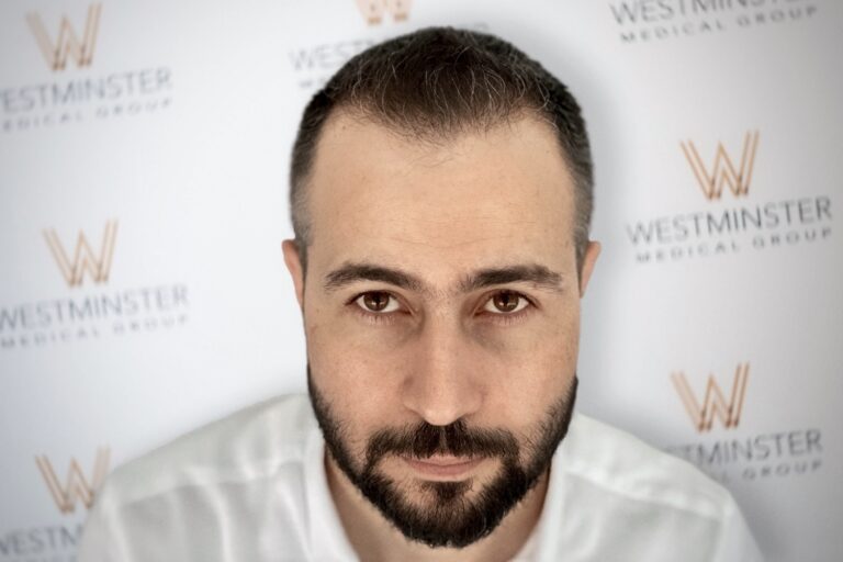 A close-up portrait of a man with a beard, looking directly at the camera, with a background featuring the logo of Westminster Medical Group repeated in a pattern, specializing in hair surgery.