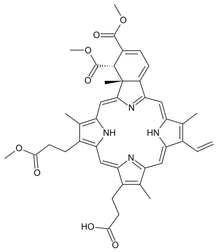 Dr. Barghouthi - Verteporfin Hair Regeneration Human Trial 1 Dr. Barghouthi - Verteporfin Hair Regeneration Human Trial 1