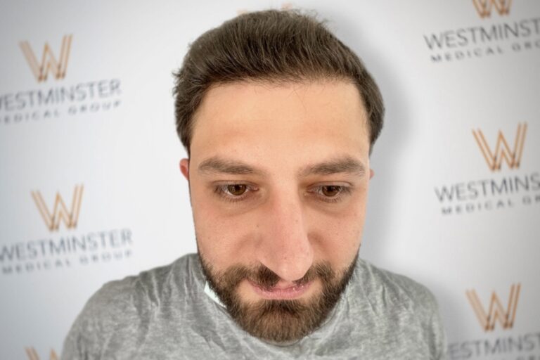 A close-up of a man with short dark hair and a beard, standing in front of a wall with the logo "Westminster Medical Group" repeatedly printed. He looks directly at the camera with a