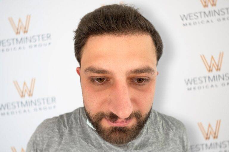 A close-up of a man's face, gazing directly at the camera with a neutral expression, set against a backdrop featuring the logo of Westminster Medical Group repeated in a pattern, highlighting their expertise in