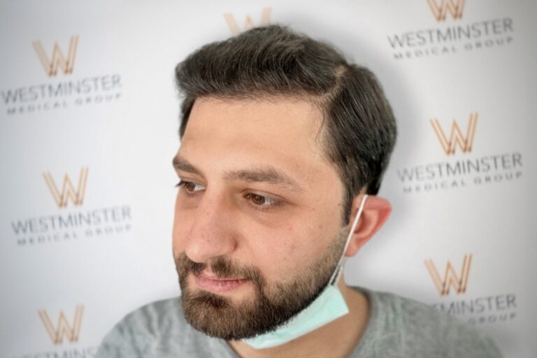 Close-up portrait of a man with a beard and a face mask pulled down to his chin, standing in front of a backdrop with the "Westminster Medical Group" logo, specializing in hair implant treatments