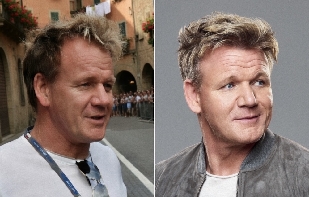 Gordon Ramsay Hair Transplant 1