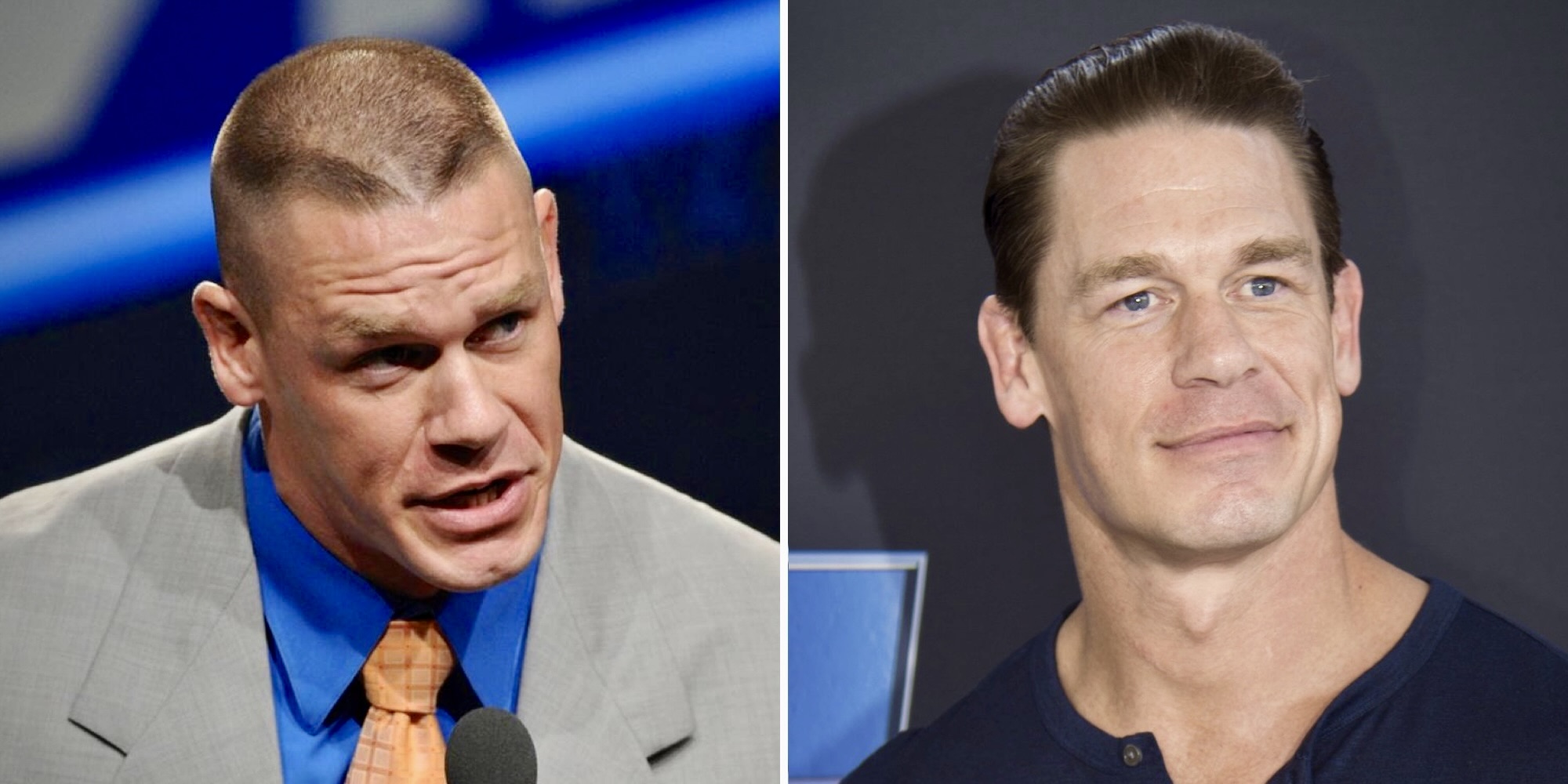 John Cena’s Hair Transplant 1